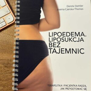 Lipoedema. Lipostukcja bez tajemnic